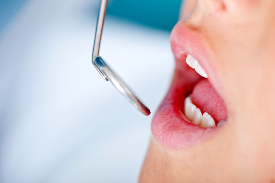 Close up Patients Mouth