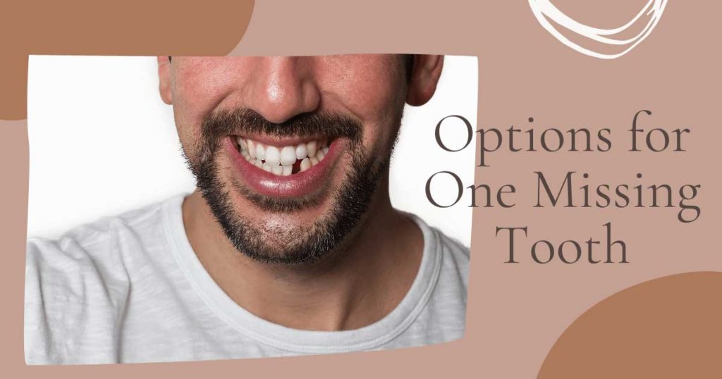 Options for One Missing Tooth Man Missing Tooth
